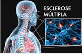 Esclerose múltipla: um quarto tem de mudar de trabalho